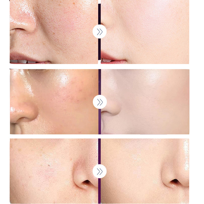 Lüks asil bayan krem inci beya - Skincare Luxury Whitening incelemesi ve fiyatı